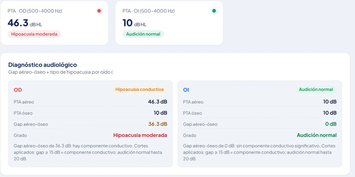 Comparación audiológica de los dos oídos con los promedios de vía aérea y de vía ósea, el gap aéreo-óseo y el grado de cada lado.
